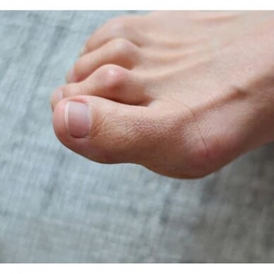 GEL HAMMER TOE CUSHION 2